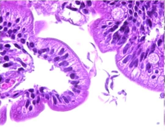 Paraziti intestinali - oxiuri, tenia - ce trebuie facut?